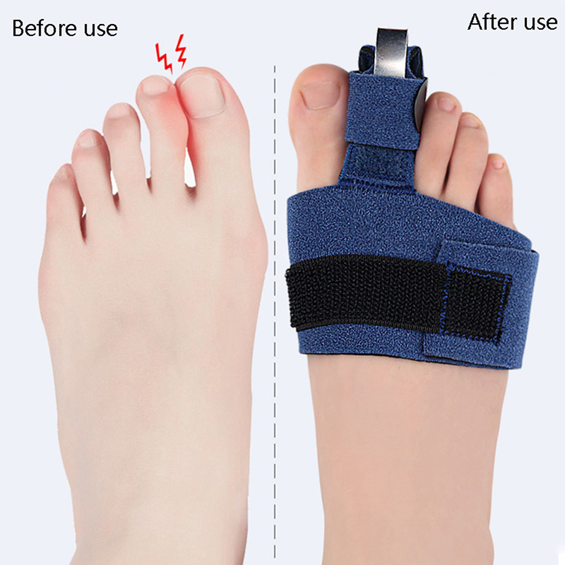 1 pieza Corrector de dedos, Fi - Ankle Brace Sock reseña y precio